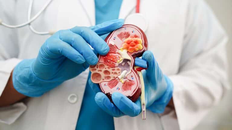 chronic kidney disease doctor holding model treatment urinary system urology estimated glomerular filtration rate egfr yt thumbnail 1280 720 LIV Hospital