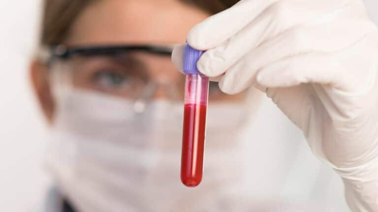 woman working laboratory close up yt thumbnail 1280 720 LIV Hospital