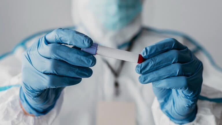 front view doctor holding blood sample yt thumbnail 1280 720 LIV Hospital