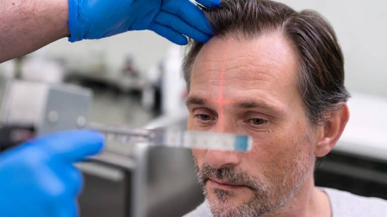 man getting hair loss treatment 1 yt thumbnail 1280 720 LIV Hospital