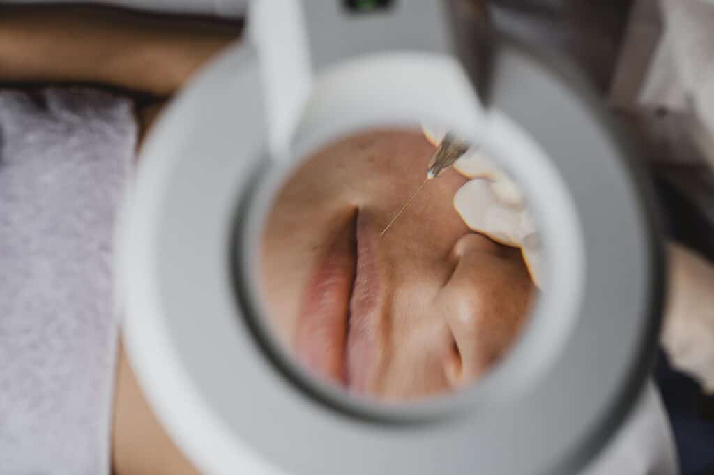 top view woman getting beauty procedure spa LIV Hospital