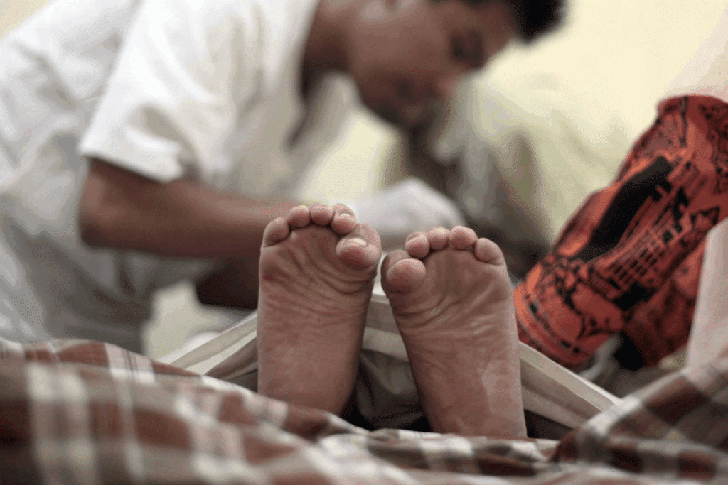 Post-Circumcision Care: Best Clothing Tips