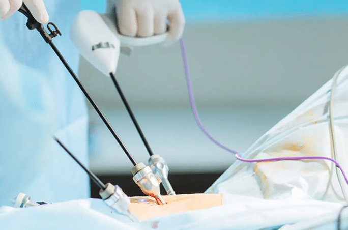 Pregnancy After Laparoscopy Timing: Guide 2 Pregnancy After Laparoscopy Timing: Guide