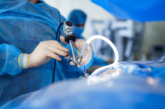 Foods to Avoid After Laparoscopy: Diet Tips