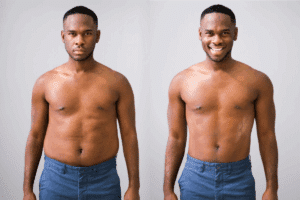 Hypopyrexia Definition: Low Body Temp