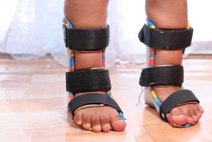 Pediatric Orthotic: Best Support Devices