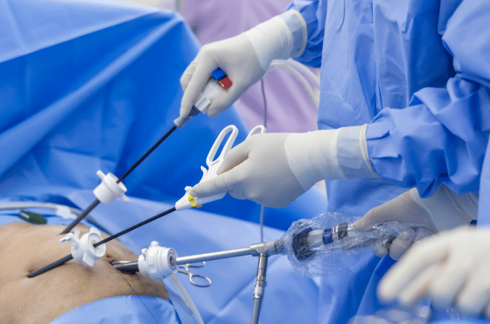 Laparoscopy Recovery: Best Rest Timeline