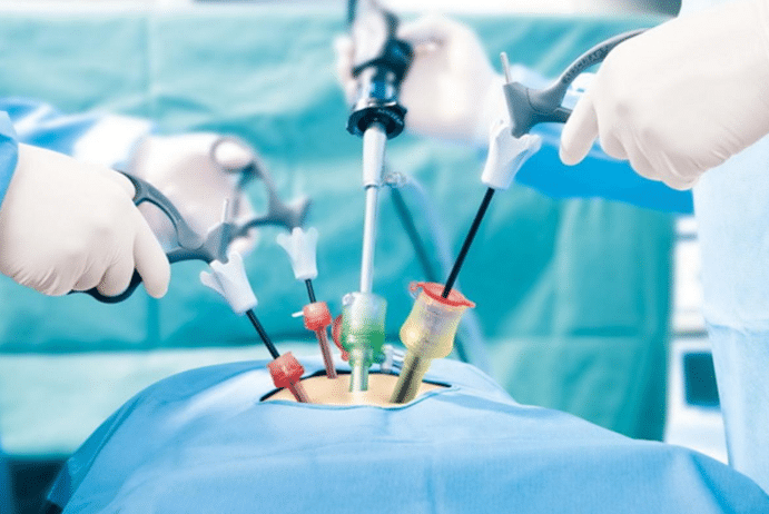 Laparoscopy Pain: Honest Recovery Guide 2 Laparoscopy Pain: Honest Recovery Guide