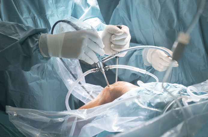 Intubation Laparoscopy: Why It Is Critical