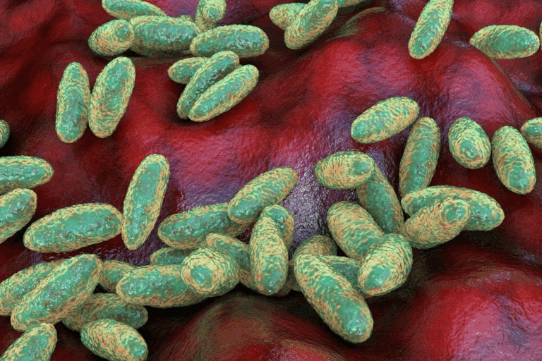 Deadliest Bacterial Infection: Lethal