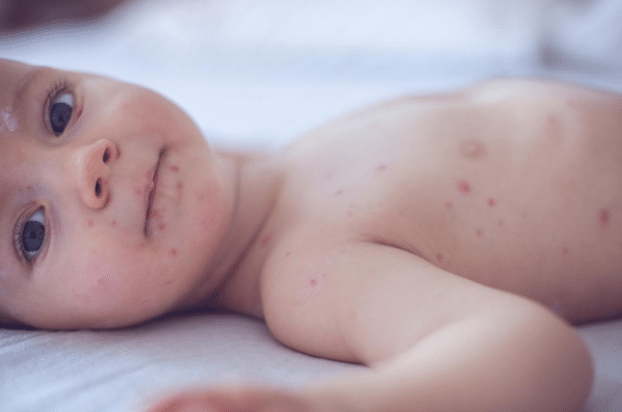 Seven Child Killer Diseases: Fatal Risks