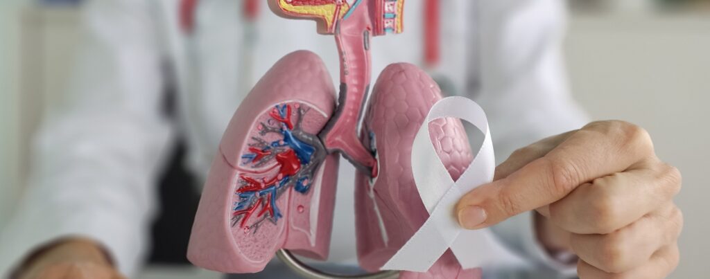 november is lung cancer awareness month lung cancer symptoms signs diagnosis 1 LIV Hospital