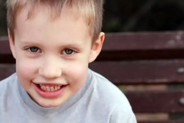 7 Signs of Autism in 10 Month Old Babies