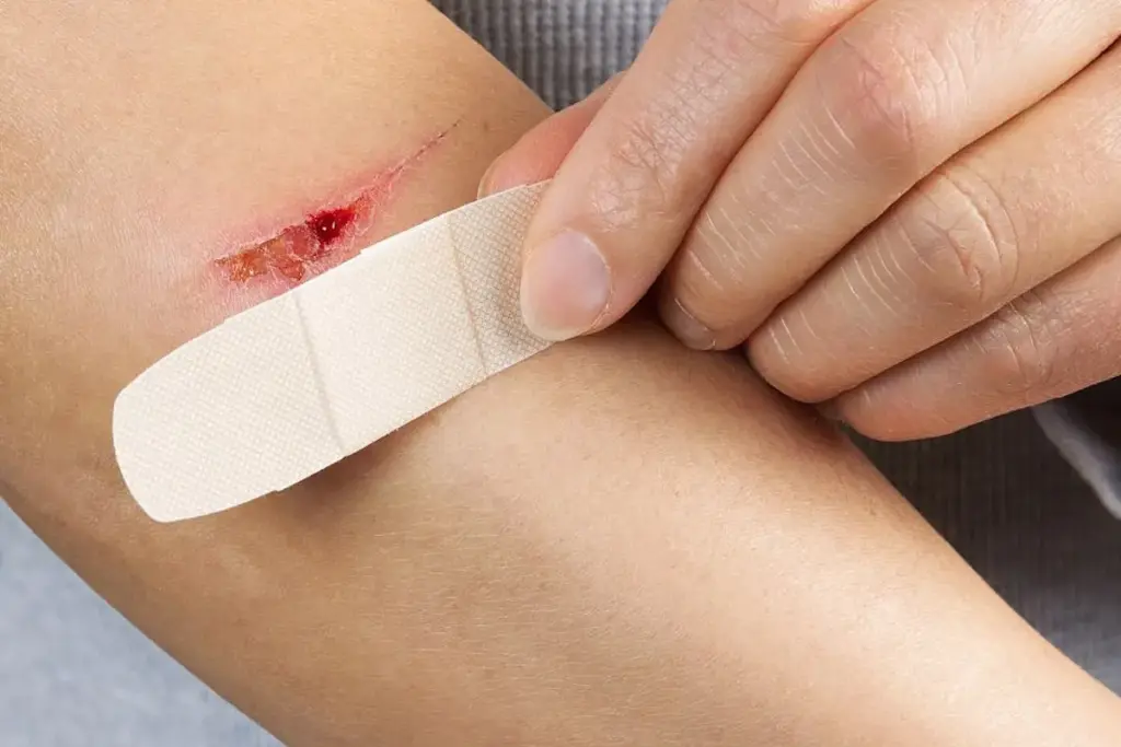 How to Heal a Scrape: Clean, Disinfect & Care