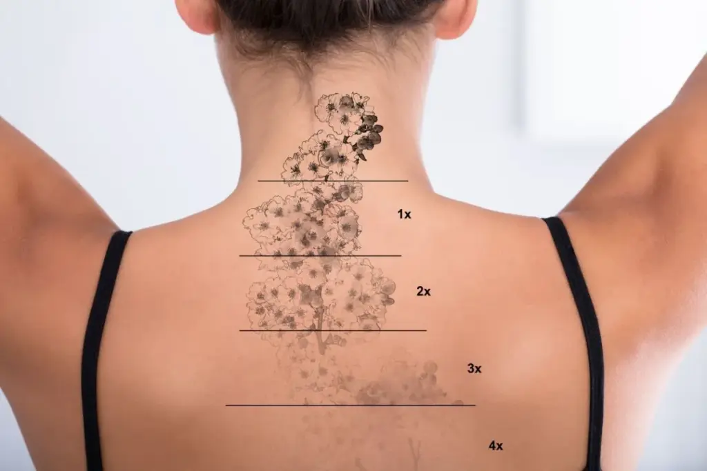 How to Erase Tattoo Naturally: 7 Proven Methods