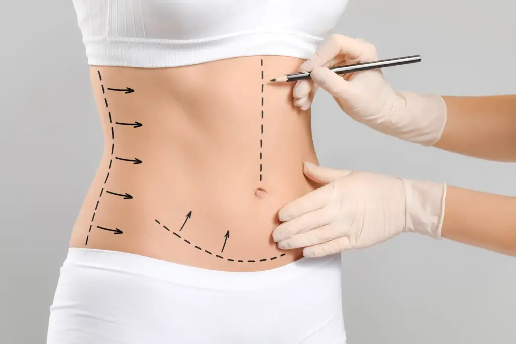 How to Achieve Immediate Fat Loss With Non-Surgical Body Sculpting