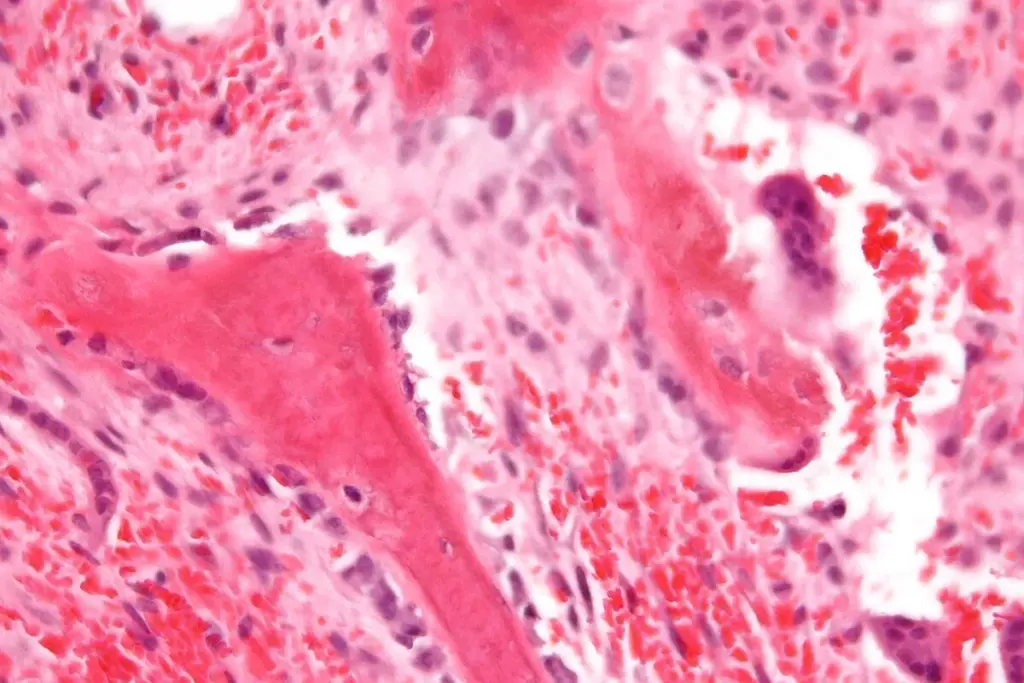 Hematopoietic: Critical Definition 2 Hematopoietic: Critical Definition