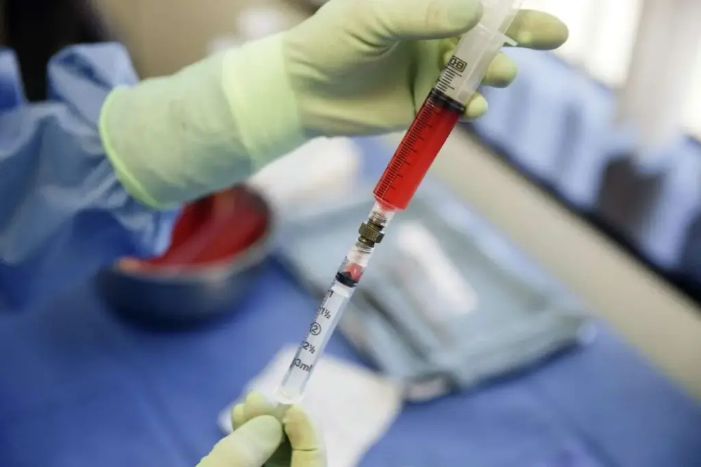 Hematopoietic stem cells: Amazing Uses 3 Hematopoietic stem cells: Amazing Uses