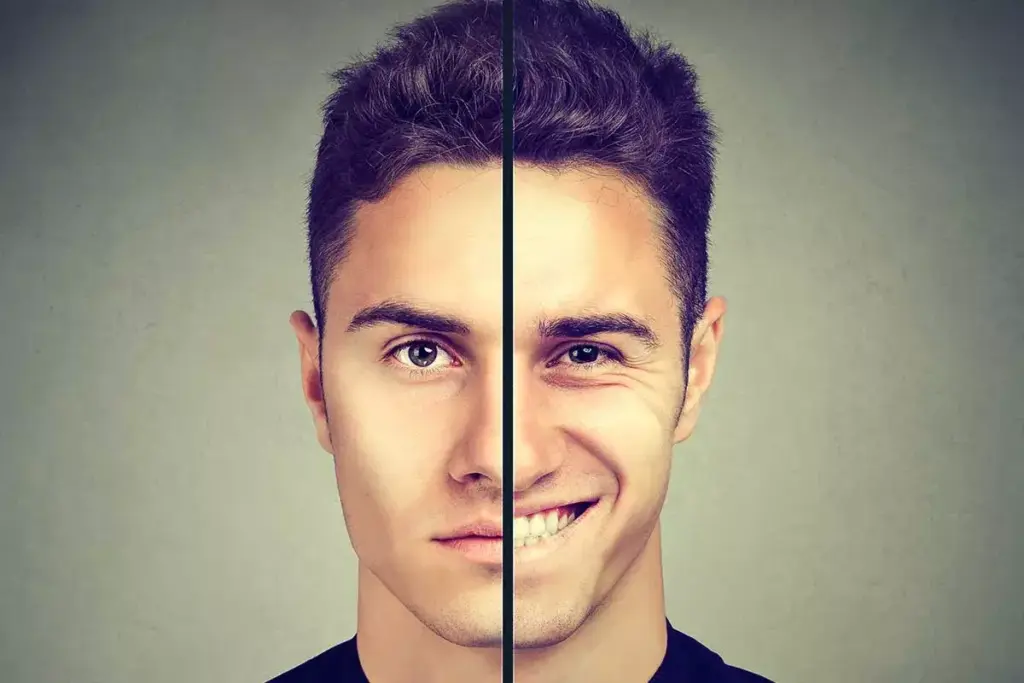 Is Bipolar Disorder a Chronic Condition That Goes Away? 2 Is Bipolar Disorder a Chronic Condition That Goes Away?