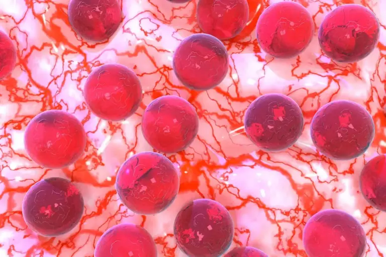 What Is Life Expectancy After a Stem Cell Transplant?