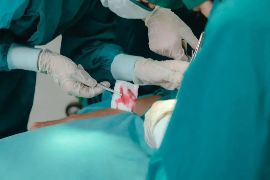 Life expectancy after stem cell transplant