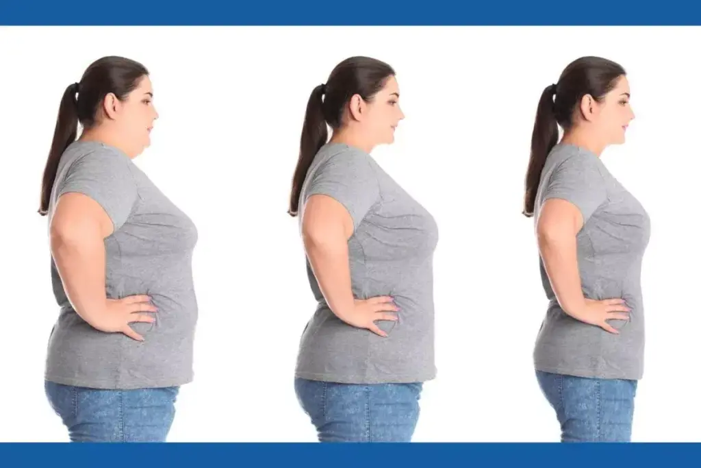 Which Antidepressants Cause Weight Loss?