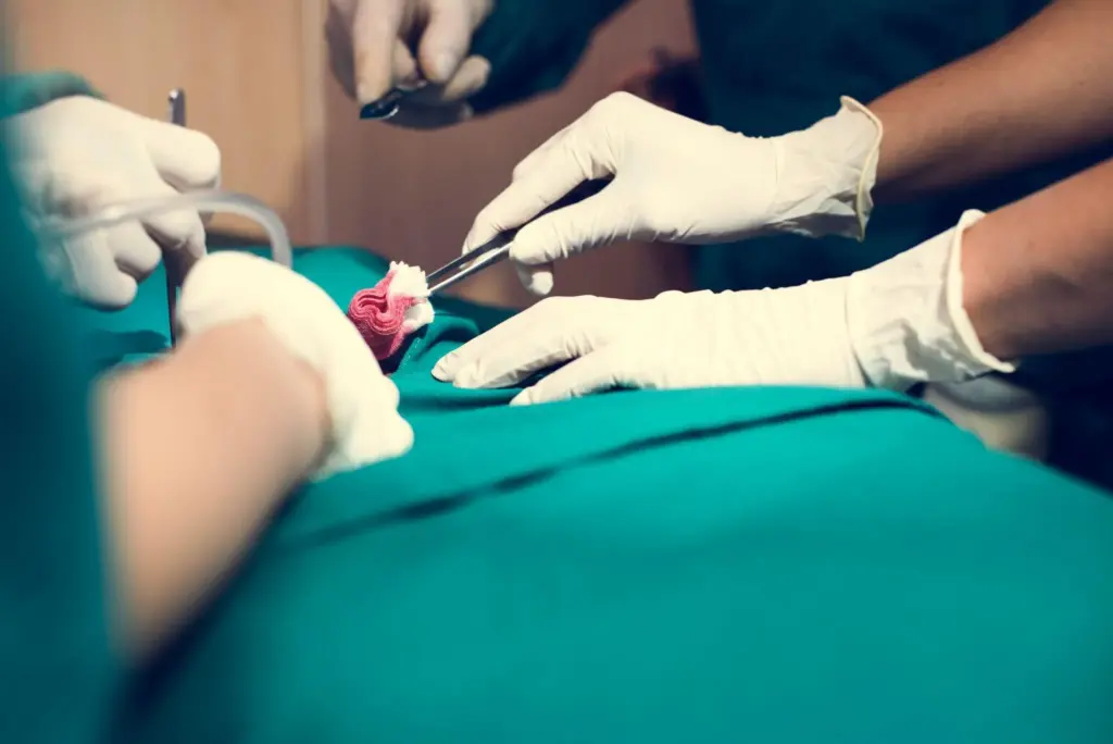 Hematopoietic cell transplantation