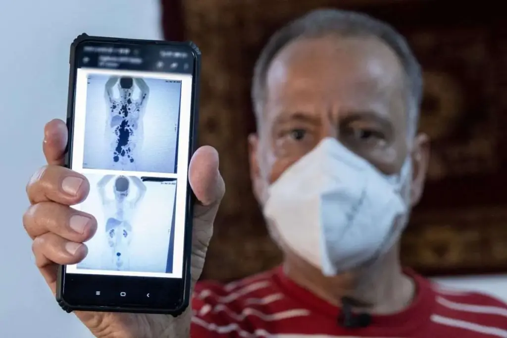 Is there a cure for cancer: Hopeful