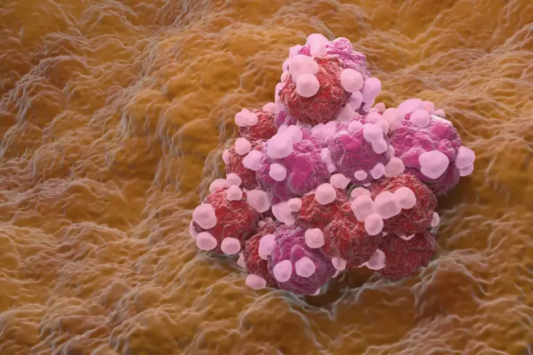 Signs Of Ovarian Cancer In Your Blood Work