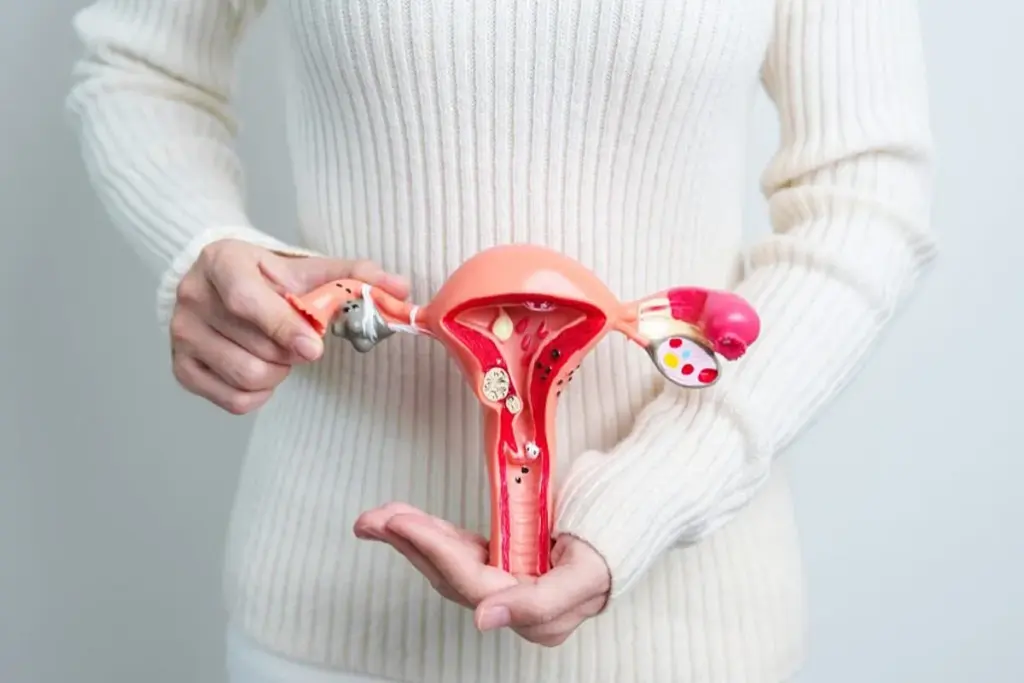 Cervicitis Symptoms: Heal Your Cervix Fast 1 Cervicitis Symptoms: Heal Your Cervix Fast