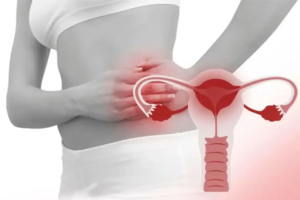 Signs Of Cervical Cancer: Is It A Uti?