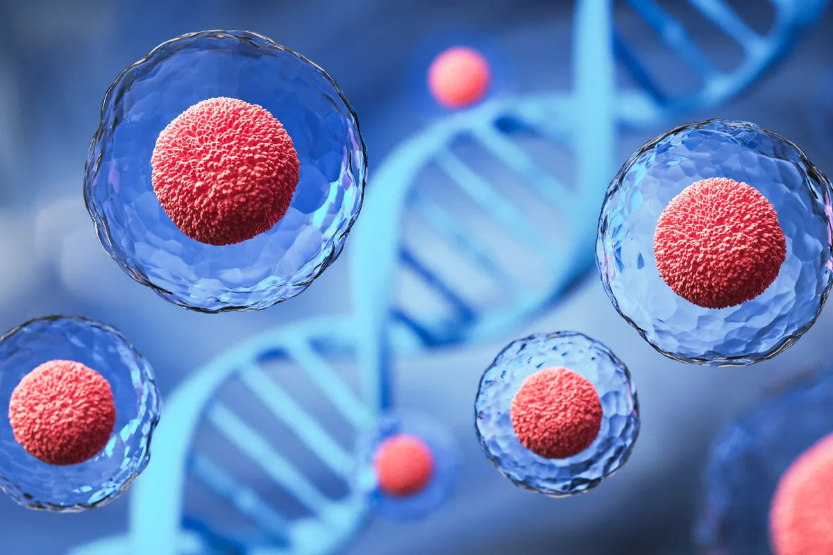 Aml Leukemia Chemotherapy: Forever Remission