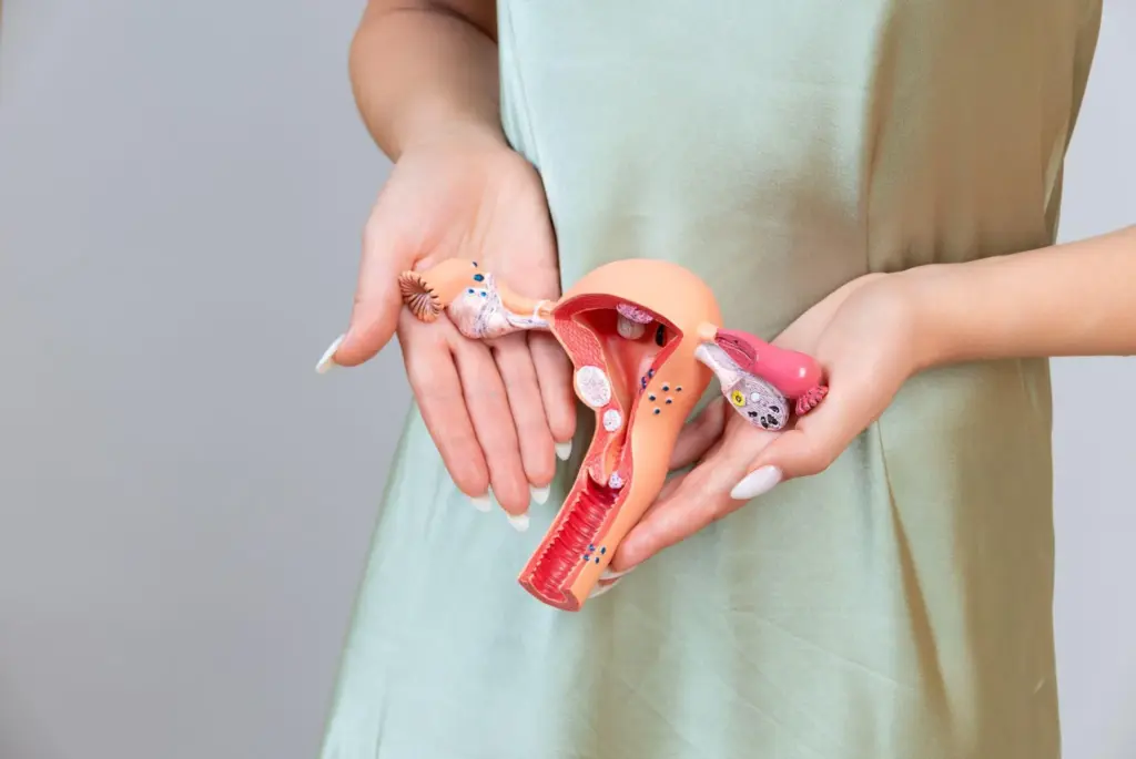 Stage 4 Ovarian Cancer: Can Spread Be Cured?