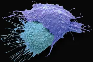 Ovarian Cancer Symptoms: Bowel Changes