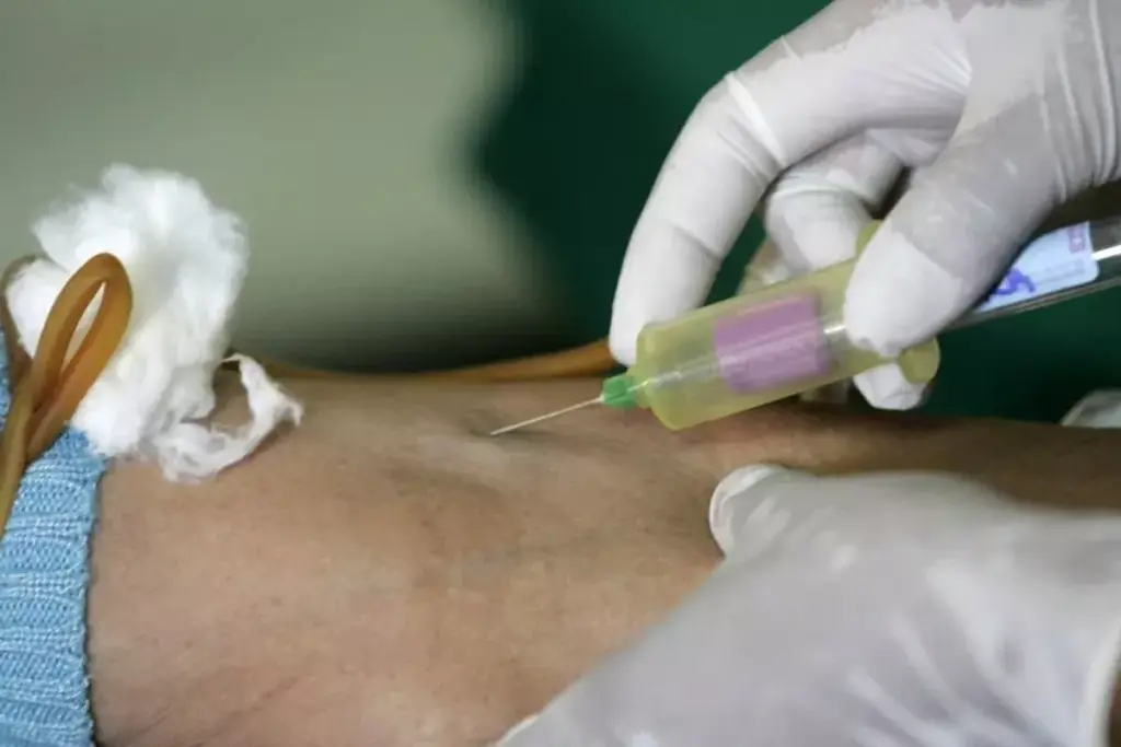 What Does High Thyroglobulin Antibody Mean?