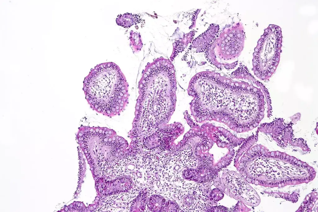 Is AIDS an Autoimmune Disease? Understanding the Differences