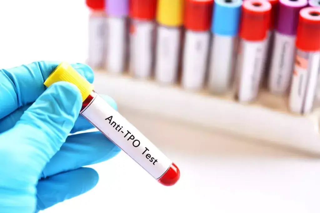 How to Understand Anti Microsomal TPO Antibody Tests