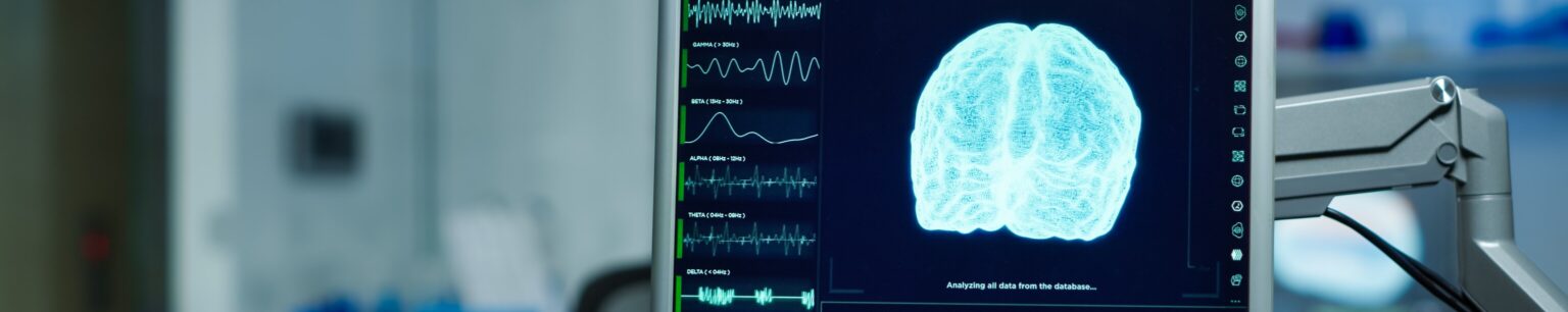 Functional Neurological Disorder