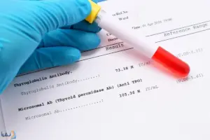 Dec 4034 image 1 LIV Hospital