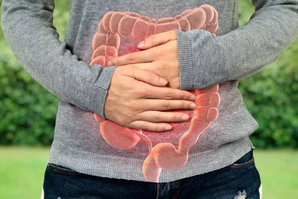 Can Celiac Disease Cause Colitis? Understanding the Connection