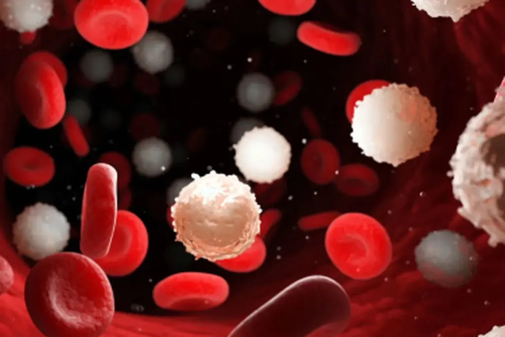 Aplastic Anemia: Can Smoking Cause It?