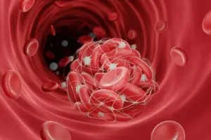 Thrombocytopenia: Low Platelet Signs