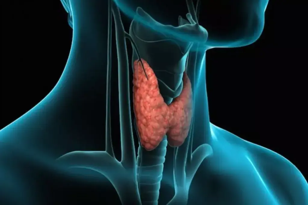 How to Fix Low Thyroid: 7 Proven Treatment Steps