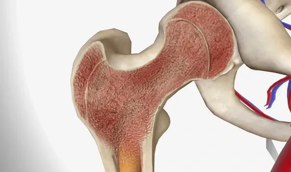 Bone Marrow Failure: Life Expectancy Facts 3 Bone Marrow Failure: Life Expectancy Facts