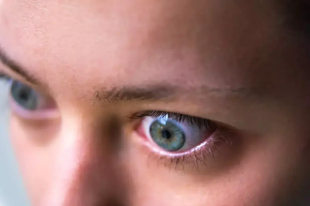 Can Graves Disease and Hyperthyroidism Cause Anxiety and Depression?