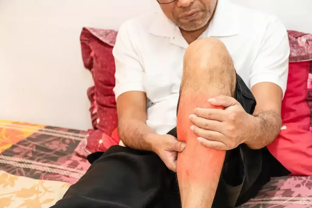 How to Diagnose Guillain-Barré Syndrome: Tests & Criteria