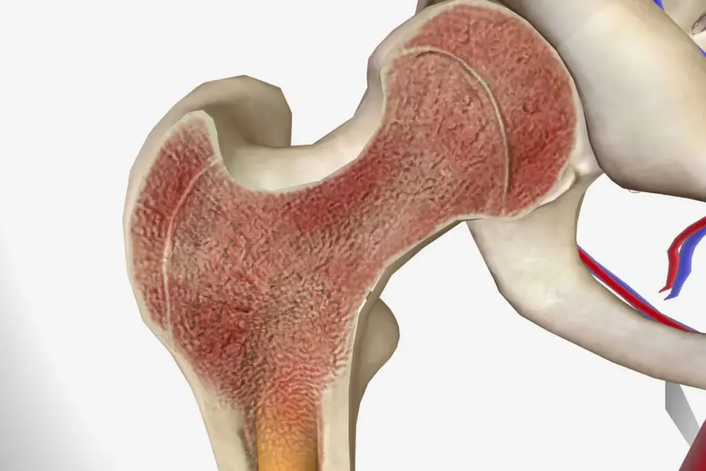 Multiple Myeloma Symptoms: Early Warning Signs 1 Multiple Myeloma Symptoms: Early Warning Signs