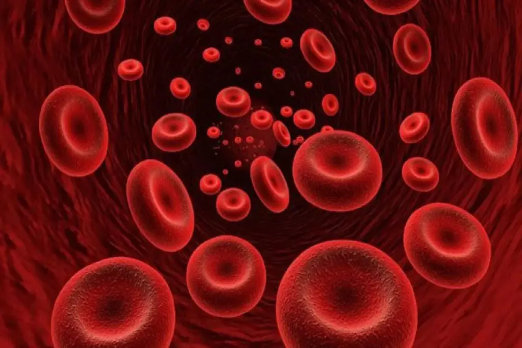 What Does A CBC Test For In Aplastic Anemia? 3 What Does A CBC Test For In Aplastic Anemia?