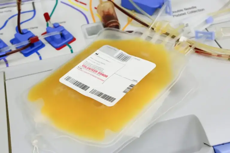 Platelet Transfusion: What Happens Next?