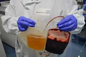 Platelet Transfusion: Timing The Count Rise